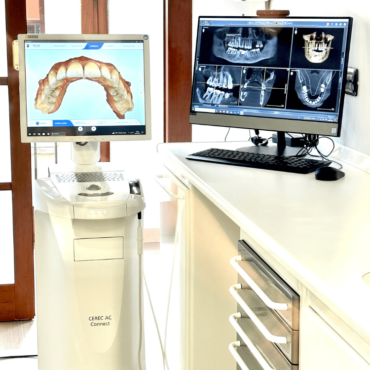 Pazienti a rischio allergie dal dentista a Rivoli e Caluso allo Studio Dentistico Rossi